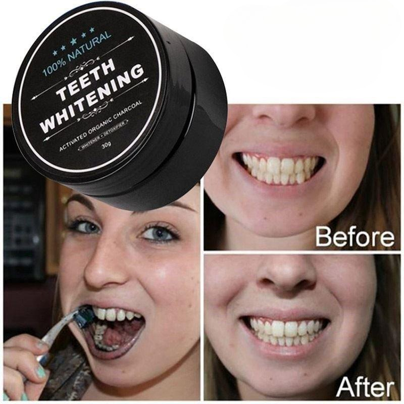 1 Box Activated Charcoal Teeth - Teeth Whitening Pens review and price